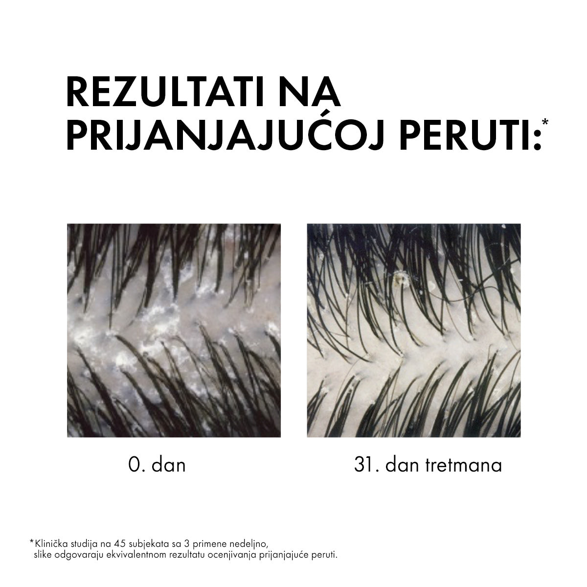 VICHY DERCOS AD Šampon protiv peruti za suvu kosu, 200 ml