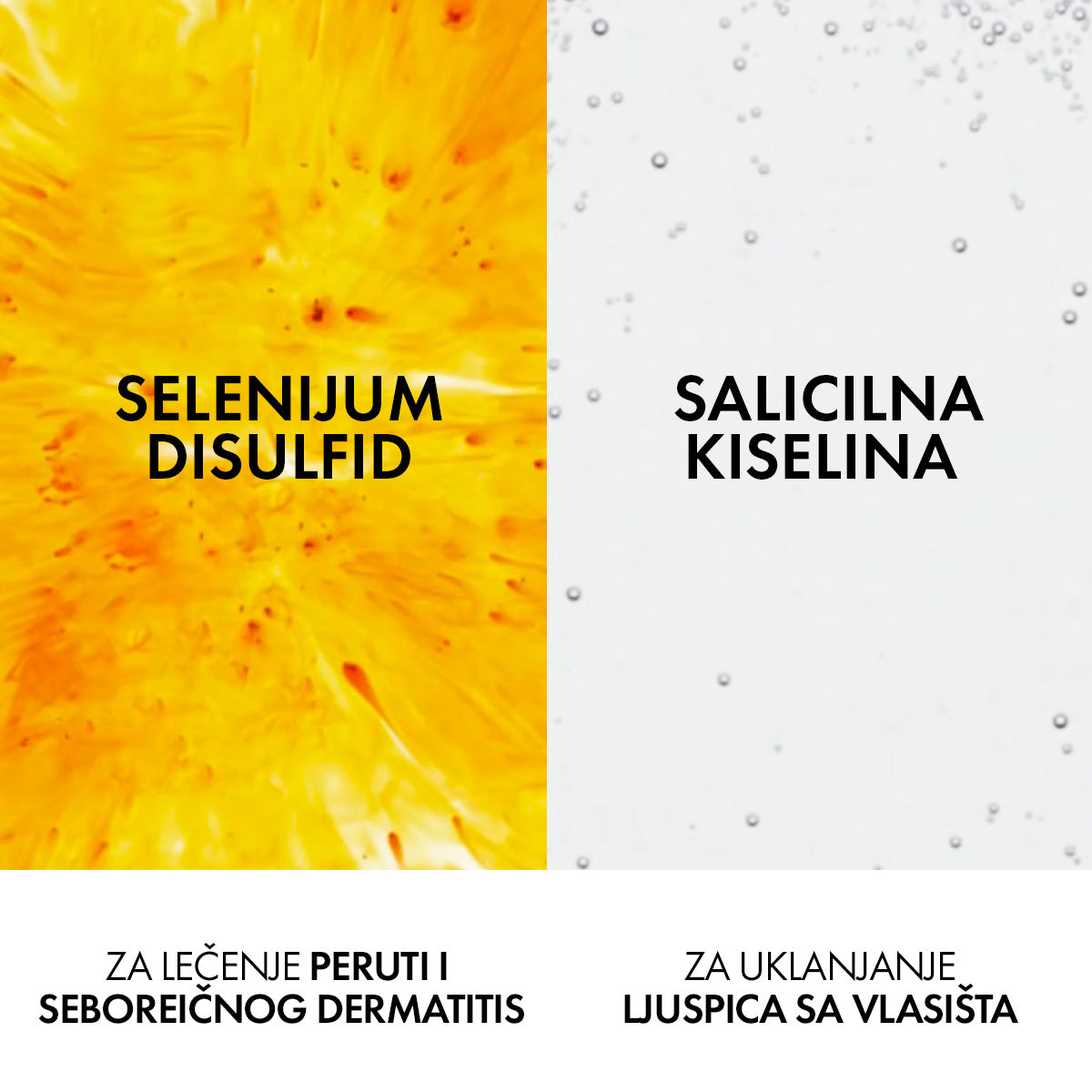 VICHY DERCOS AD Šampon protiv peruti za normalnu ili masnu kosu, 390 ml
