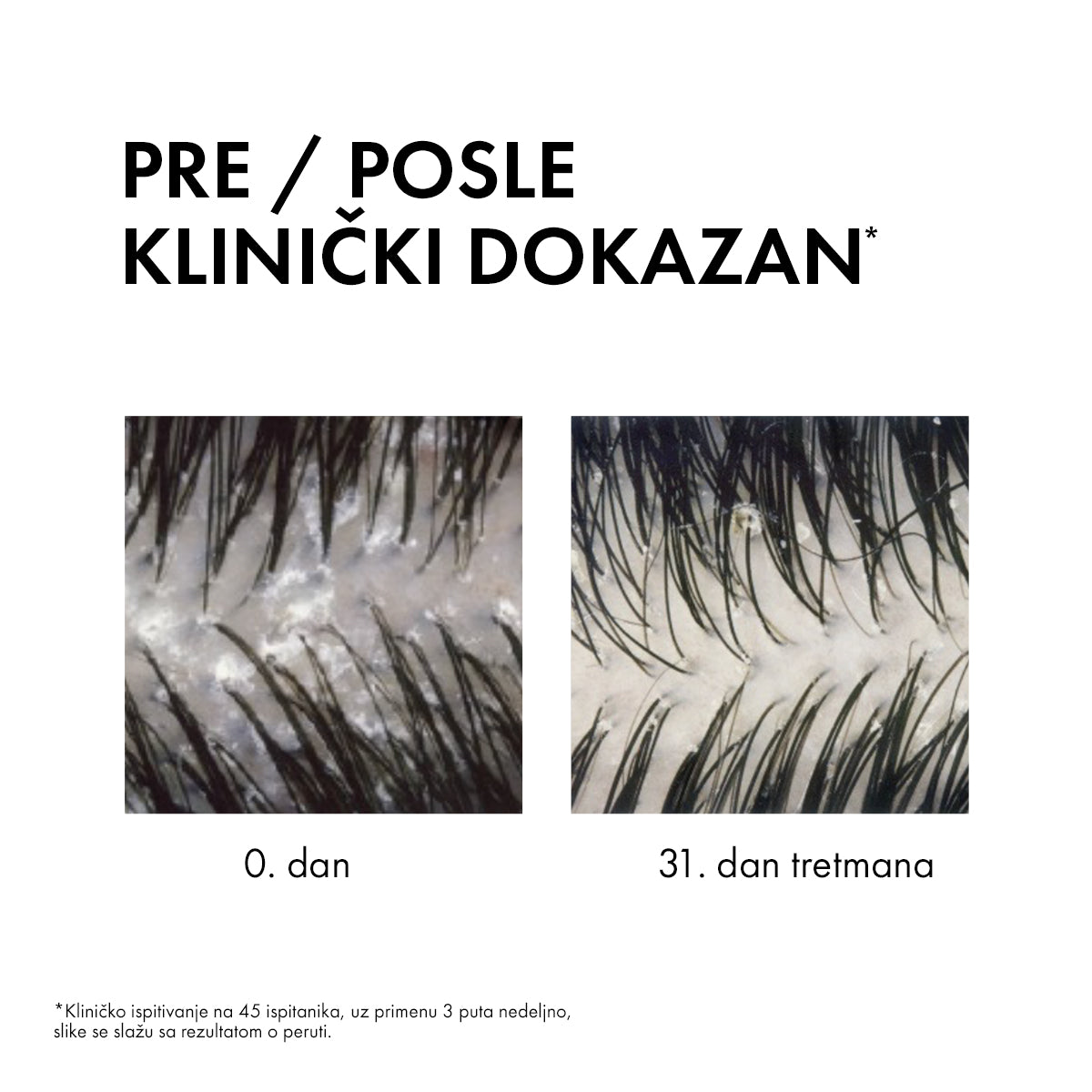 VICHY DERCOS šampon protiv peruti DS - 2 u 1: Dermokozmetički šampon i regenerator, 200 ml