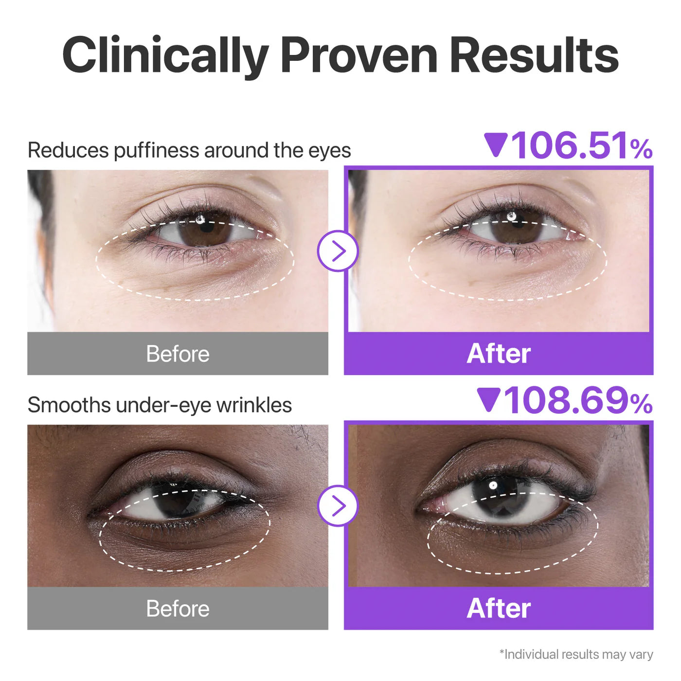 NUMBUZIN NO.9 NAD COLLAGEN UNDER EYE PATCHES 5/1